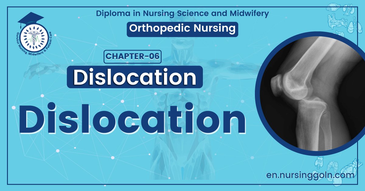 Medical Definition of Dislocation | CHAPTER 6 | Orthopedic Nursing
