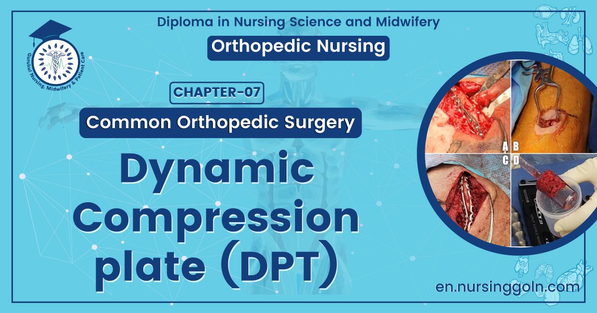 Dynamic compression plate (DCP) | CHAPTER 7 | Orthopedic Nursing