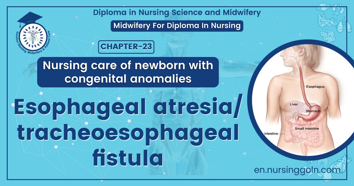 Esophageal atresia/tracheoesophageal fistula