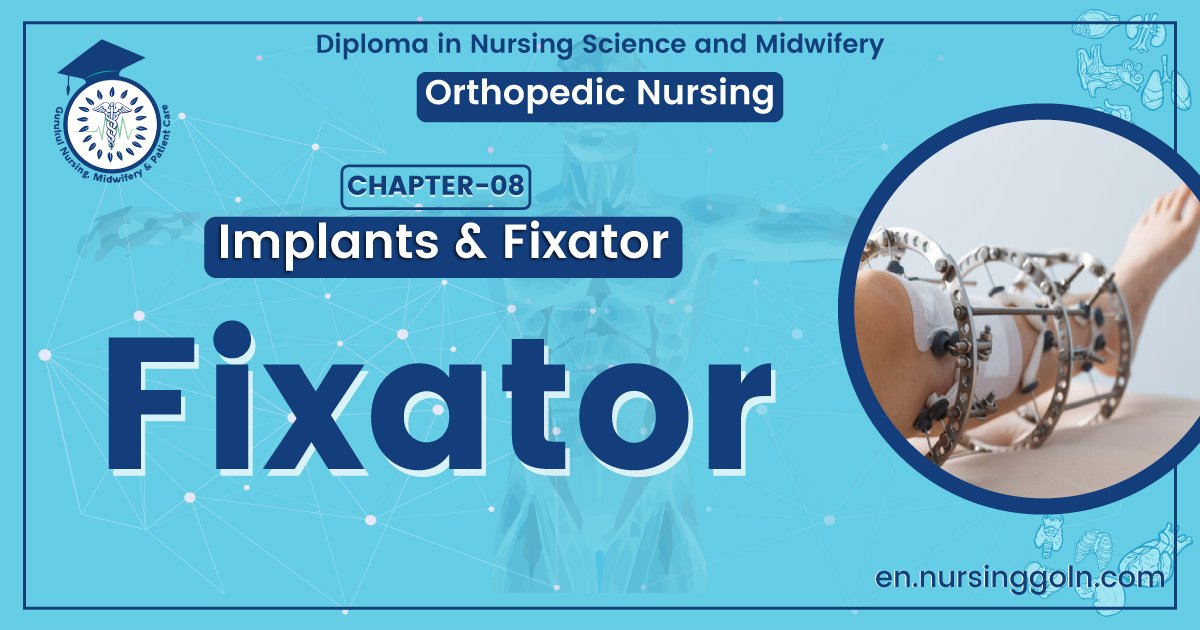 Definition of Fixation | CHAPTER 8 | Orthopedic Nursing