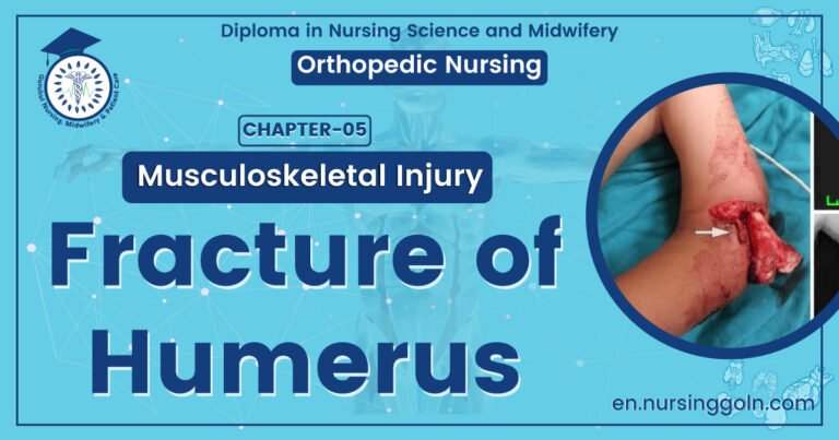 Fracture of Humerus | CHAPTER 5 | Orthopedic Nursing