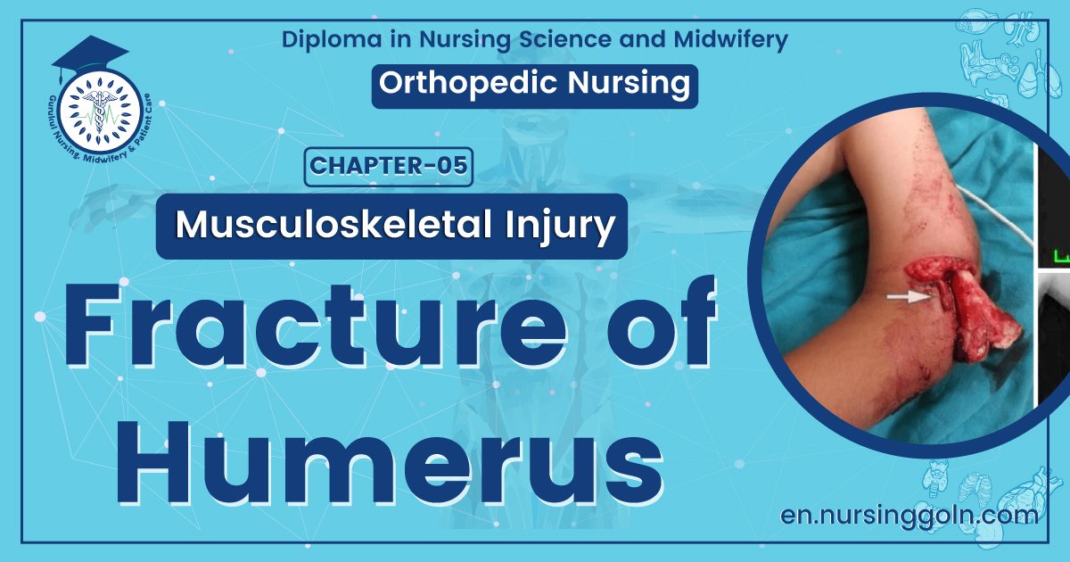 Fracture of Humerus | CHAPTER 5 | Orthopedic Nursing