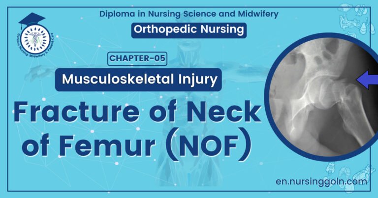Fracture of Neck of Femur (NOF) | CHAPTER 5 | Orthopedic Nursing