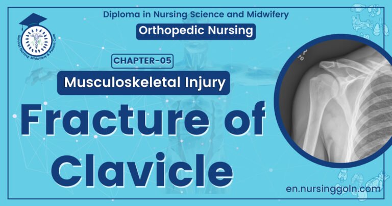 Fracture of clavicle | CHAPTER 5 | Orthopedic Nursing