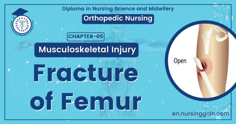 Fracture of Femur | CHAPTER 5 | Orthopedic Nursing