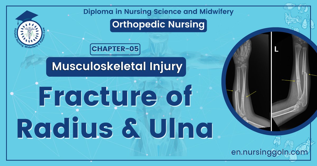 Fracture of radius & Ulna | CHAPTER 5 | Orthopedic Nursing