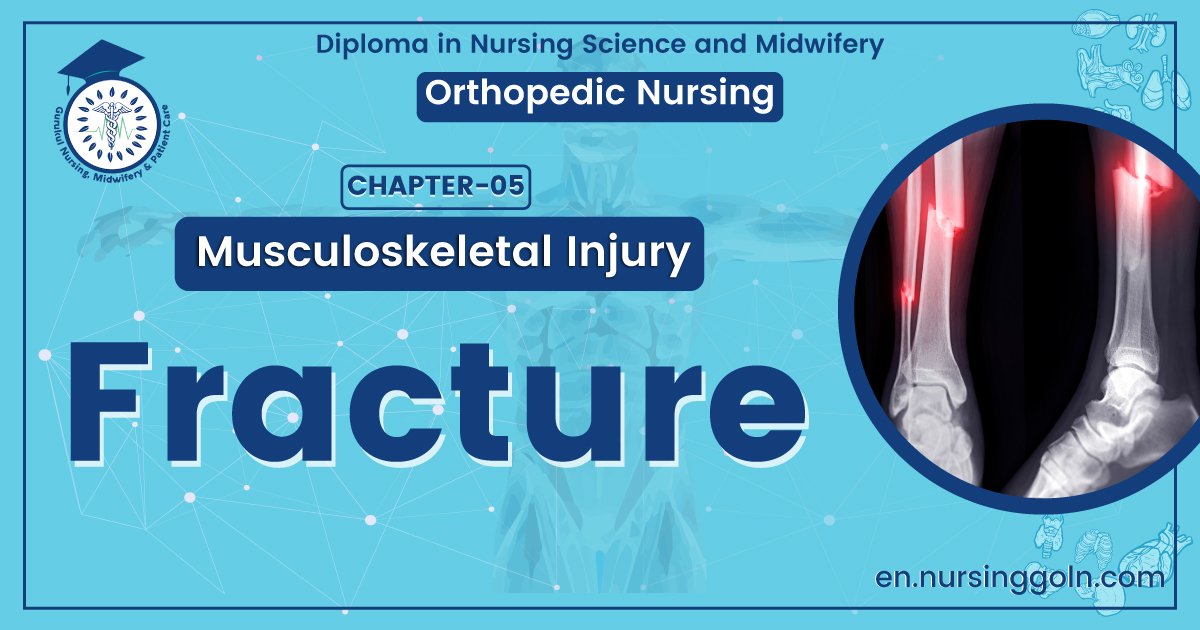 Medical Definition of Fracture | CHAPTER 5 | Orthopedic Nursing