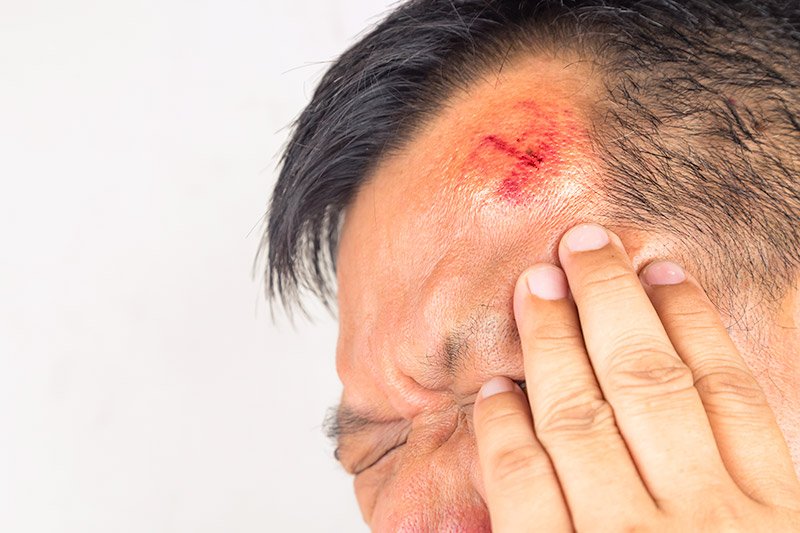 Head Injury | CHAPTER 22 | Orthopedic Nursing