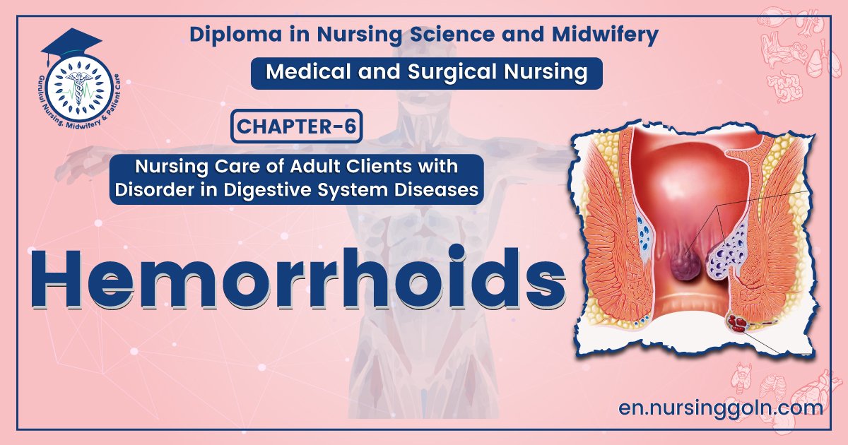 Definition of Hemorrhoids | CHAPTER-6 | Medical and Surgical Nursing