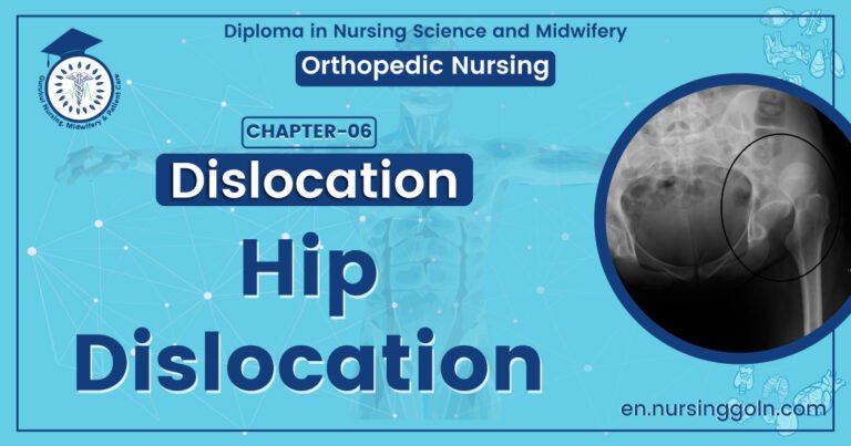 Hip Dislocation | CHAPTER 6 | Orthopedic Nursing