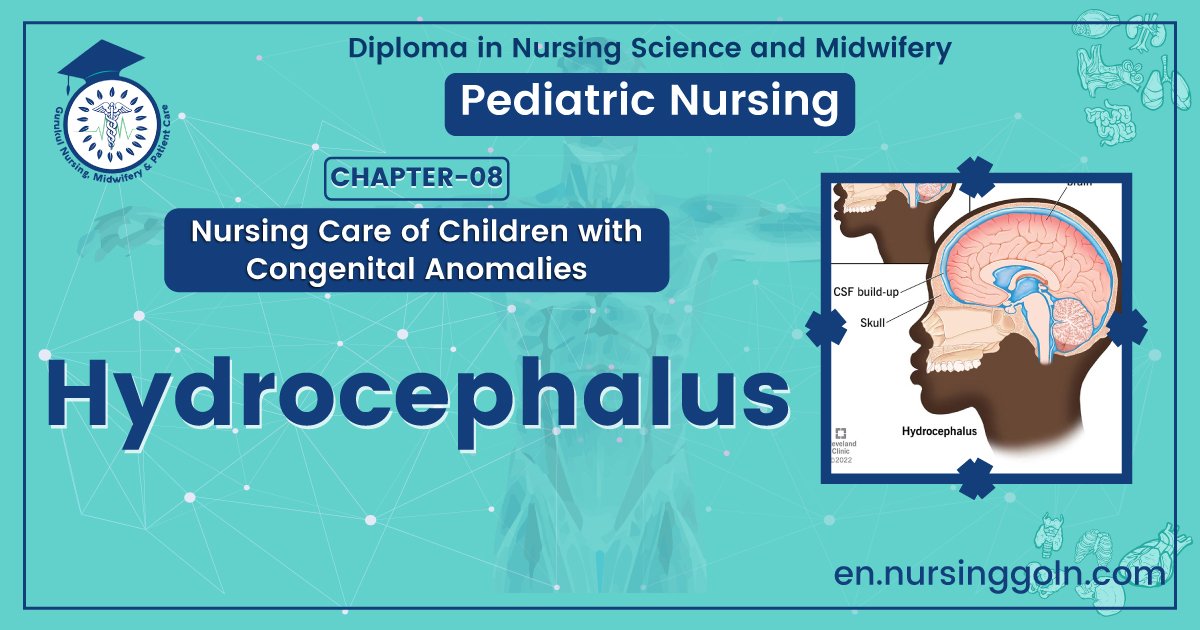 Concept about Hydrocephalus | CHAPTER 8 | Pediatric Nursing
