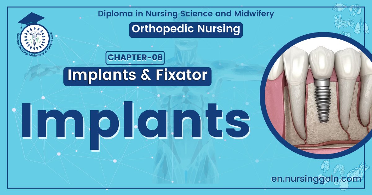 Definition of Implants | CHAPTER 8 | Orthopedic Nursing