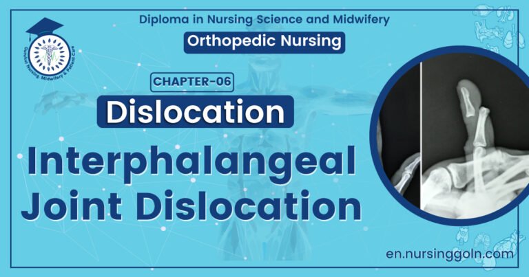 Interphalangeal joint dislocation | CHAPTER 6 | Orthopedic Nursing