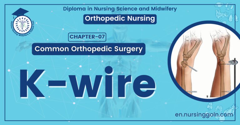 Definition of K-wire | CHAPTER 7 | Orthopedic Nursing