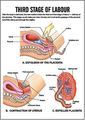 Third Stage Of Labor | Chapter 13 | Midwifery For Diploma In Nursing