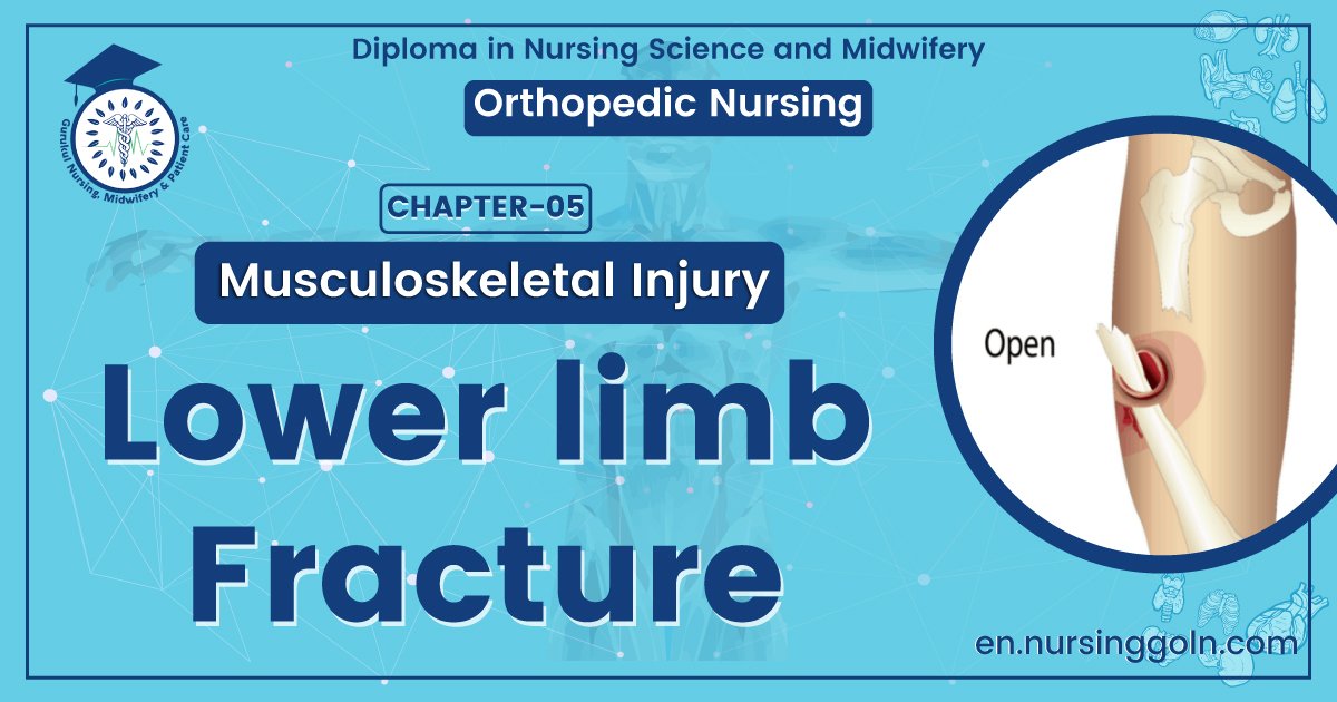 Lower limb fracture | CHAPTER 5 | Orthopedic Nursing