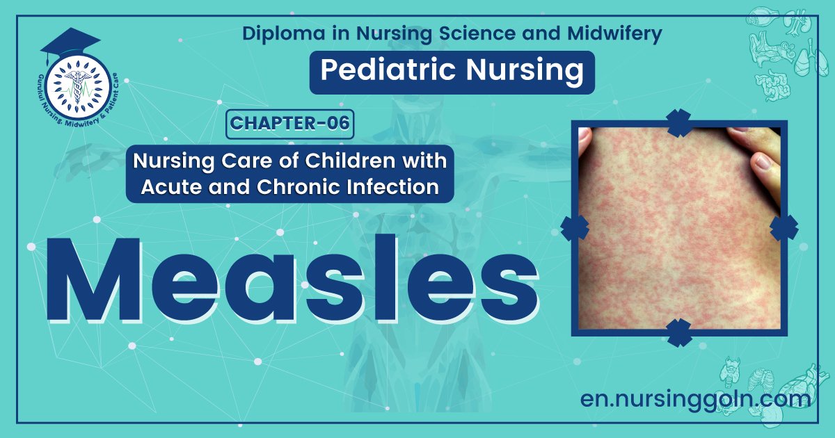 Definition of Measles | CHAPTER 6 | Pediatric Nursing