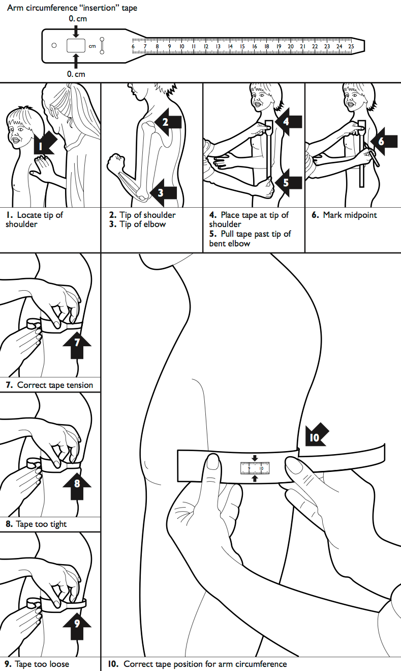 mid upper arm circumference