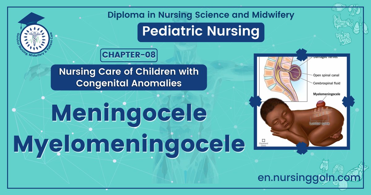 Meningocele or Myelomeningocele | CHAPTER 8 | Pediatric Nursing