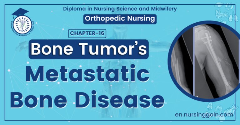 Metastatic Bone Disease | CHAPTER 16 | Orthopedic Nursing