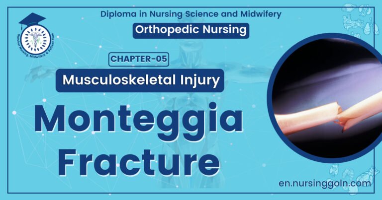 Monteggia fracture | CHAPTER 5 | Orthopedic Nursing
