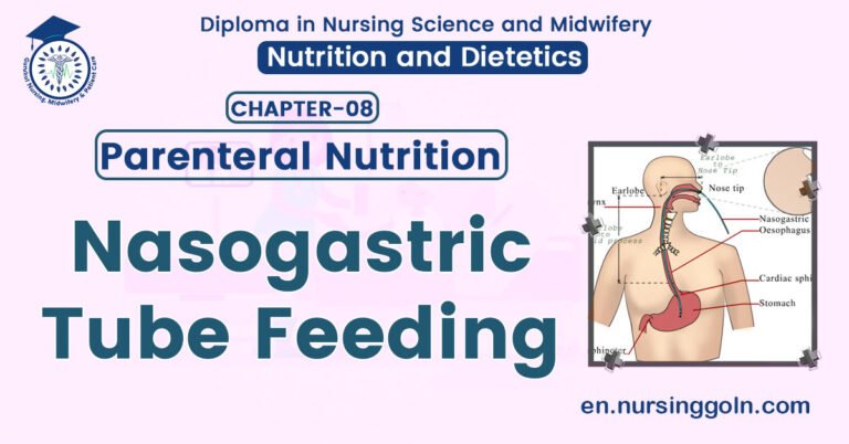 Nasogastric Tube Feeding