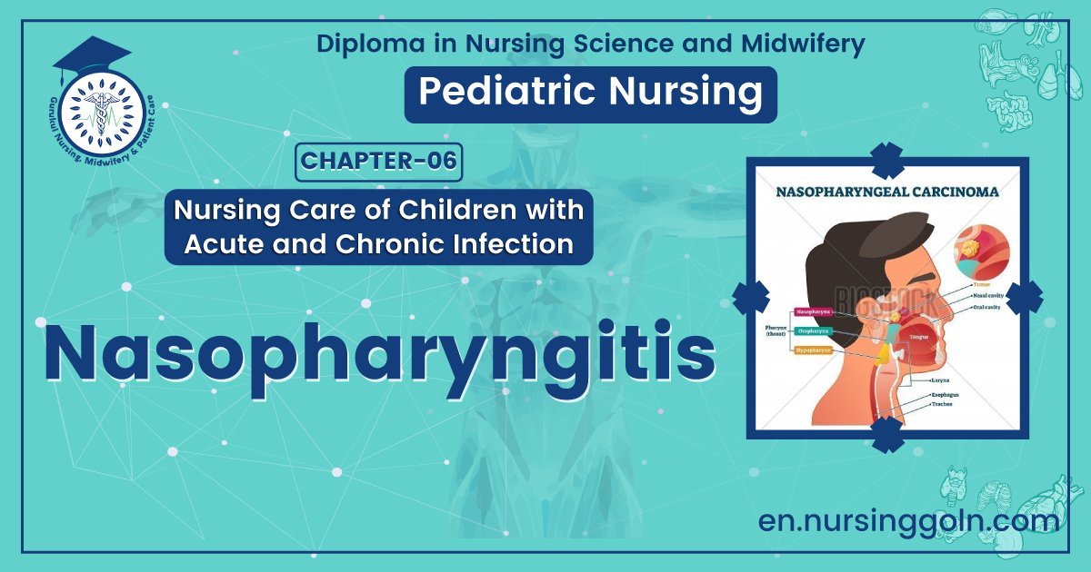 Definition of Nasopharyngitis | CHAPTER 6 | Pediatric Nursing