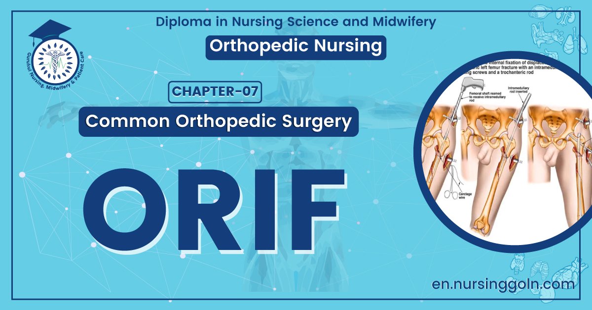 Definition ORIF | CHAPTER 7 | Orthopedic Nursing