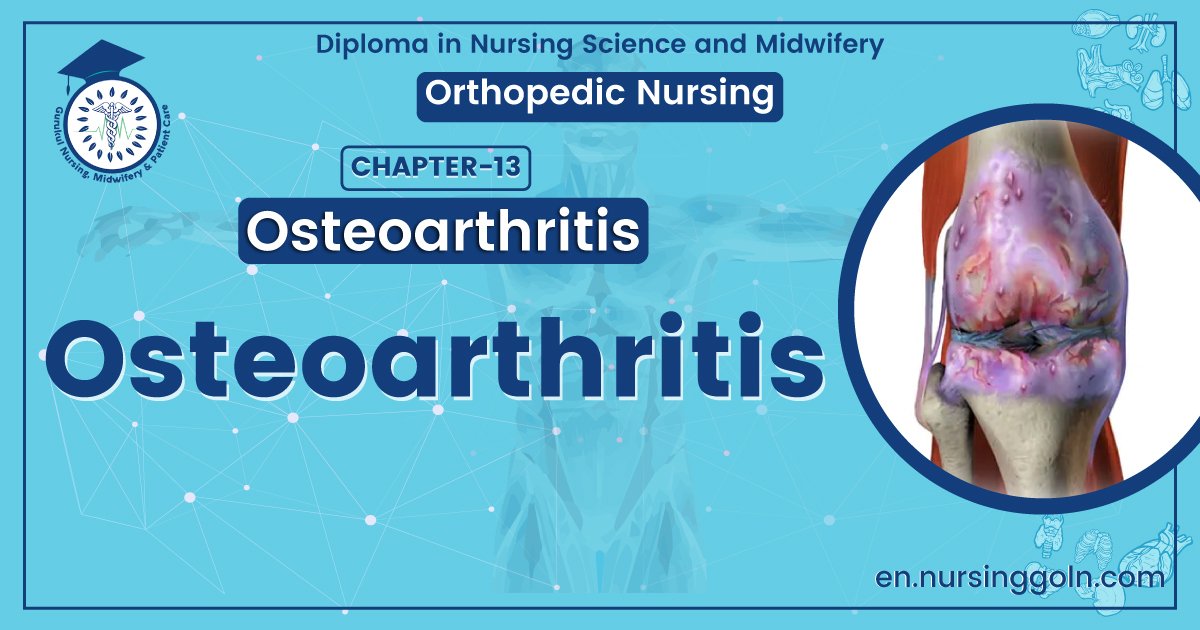 Concept about Osteoarthritis | CHAPTER 13 | Orthopedic Nursing