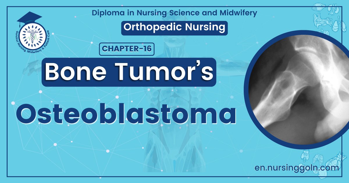 Concept about Osteoblastoma | CHAPTER 16 | Orthopedic Nursing