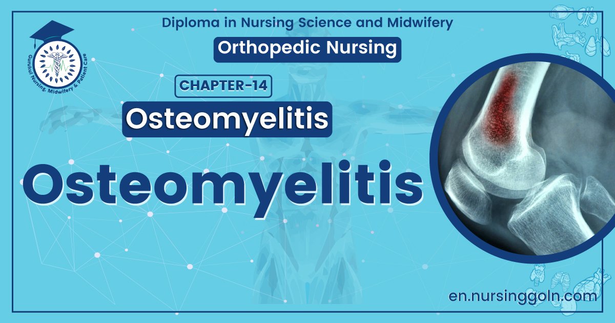 Concept about Osteomyelitis | CHAPTER 14 | Orthopedic Nursing