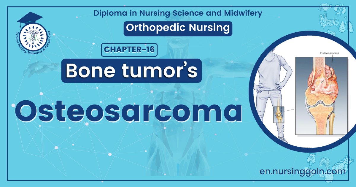 Concept about Osteosarcoma | CHAPTER 16 | Orthopedic Nursing