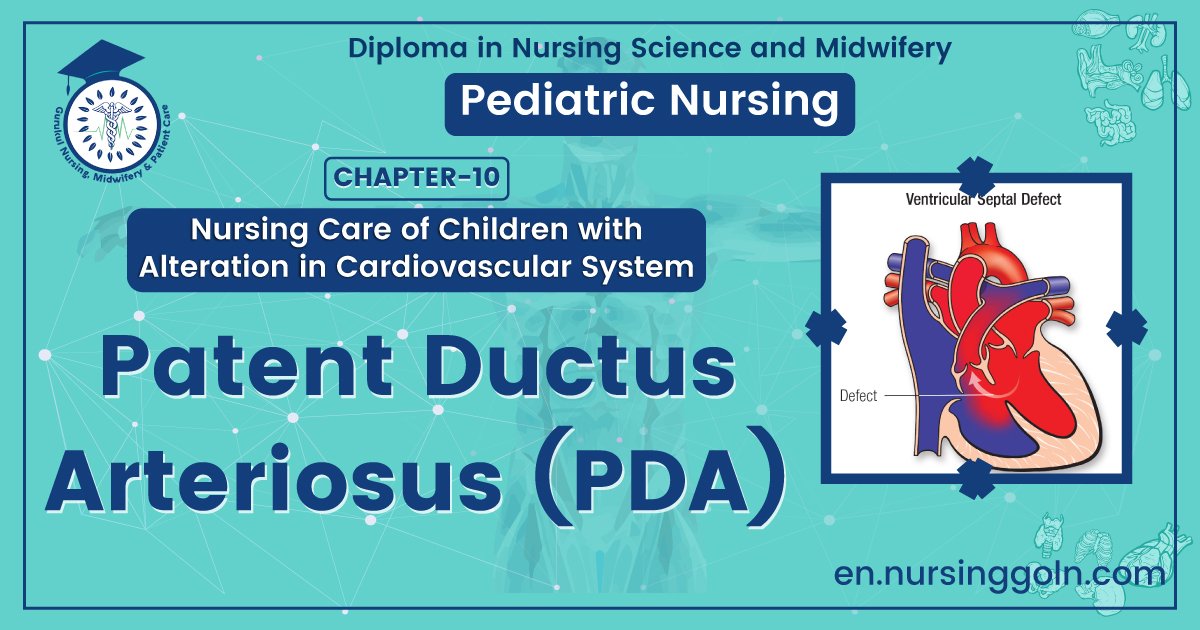 Patent ductus arteriosus (PDA) | CHAPTER 10 | Pediatric Nursing
