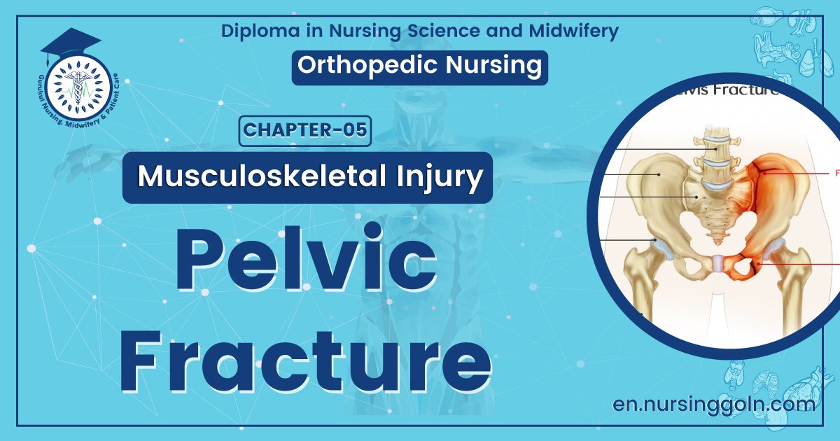 Pelvic fracture | CHAPTER 5 | Orthopedic Nursing