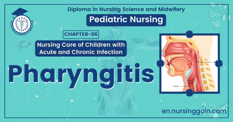 Definition of Pharyngitis | CHAPTER 6 | Pediatric Nursing