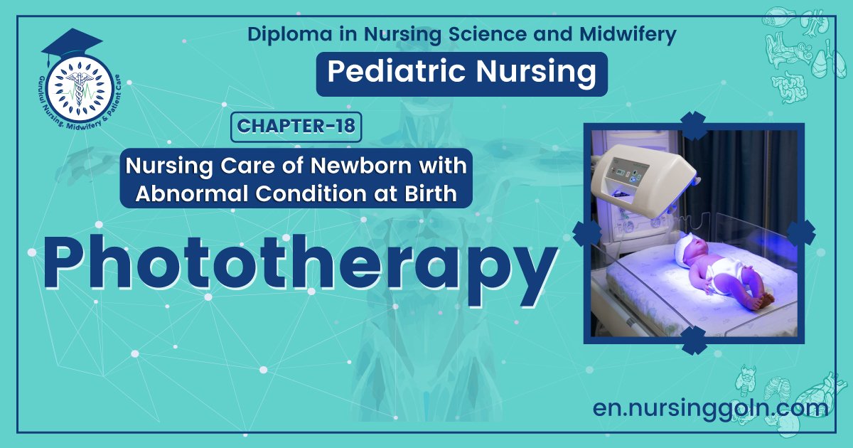 Concept of Phototherapy | CHAPTER 18 | Pediatric Nursing