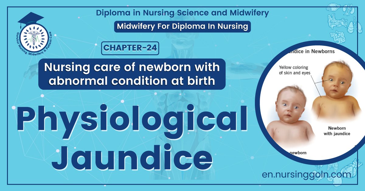 Physiological jaundice