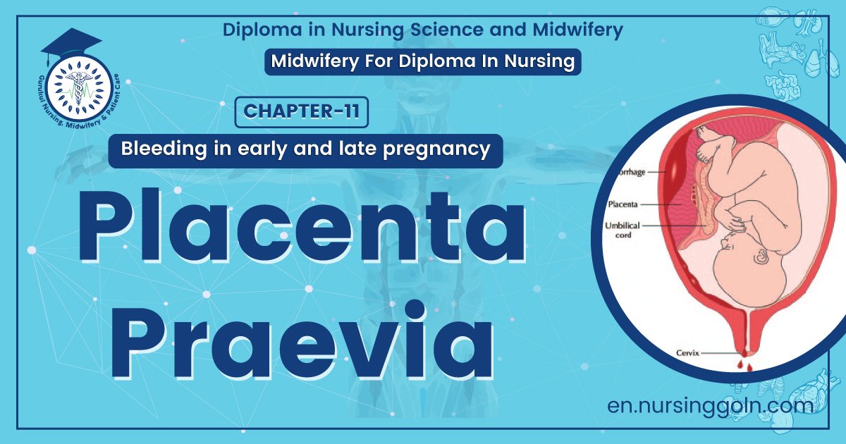 Placenta Praevia | Chapter 11 | Midwifery For Diploma In Nursing