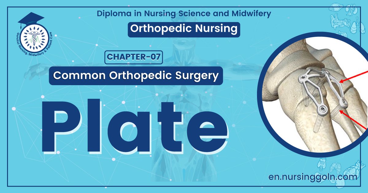 Definition of Plate | CHAPTER 7 | Orthopedic Nursing