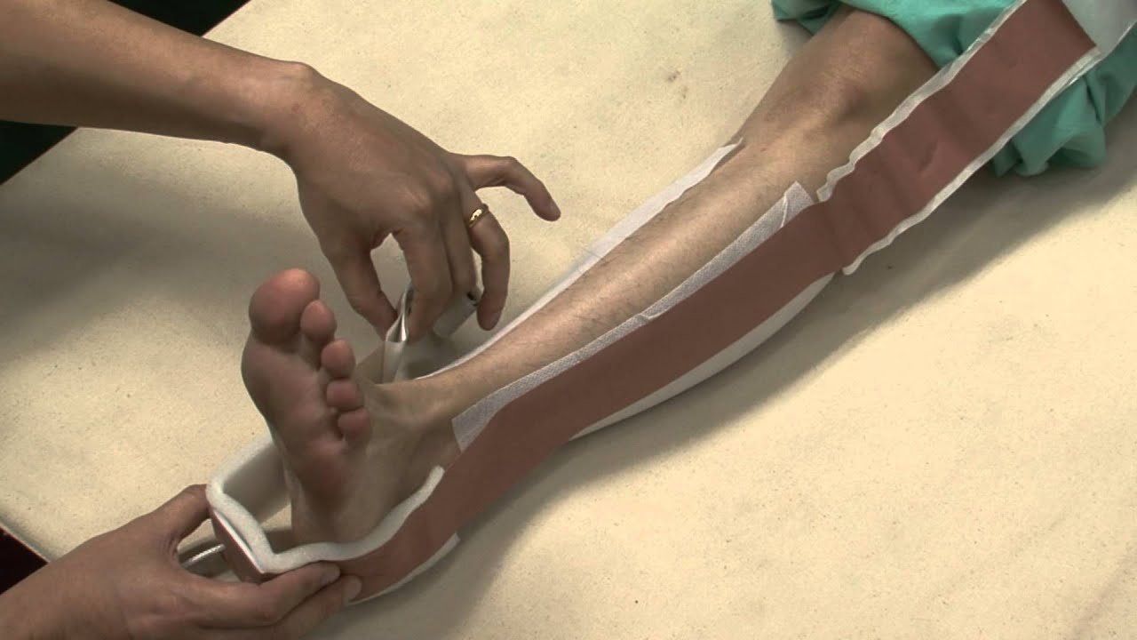 Skin Traction | CHAPTER 21 | Orthopedic Nursing