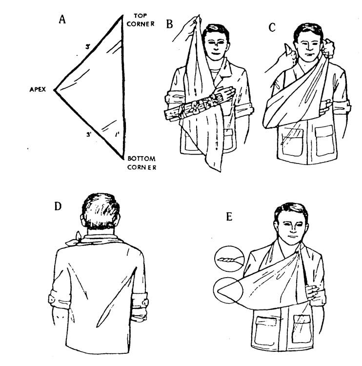Concept About Triangular Bandage | CHAPTER 21 | Orthopedic Nursing