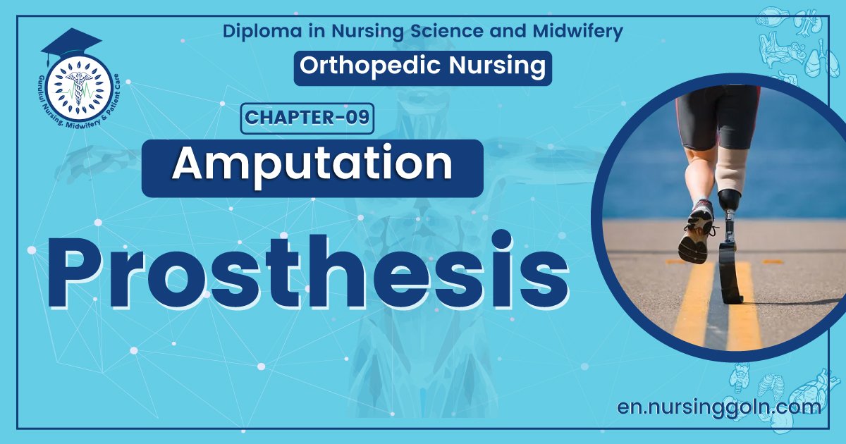 Definition of prosthesis | CHAPTER 9 | Orthopedic Nursing