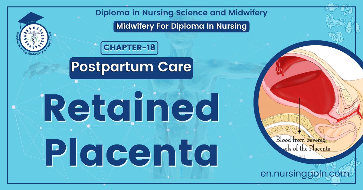 Retained Placenta
