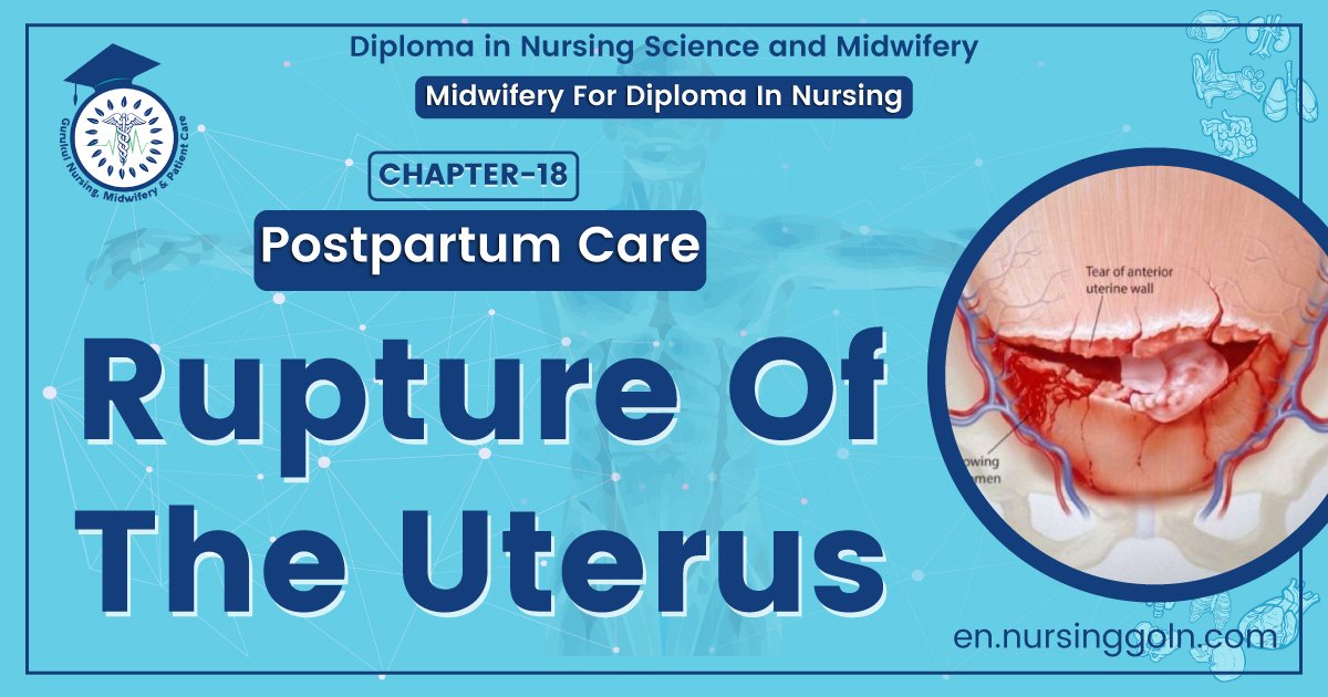 Rupture Of The Uterus