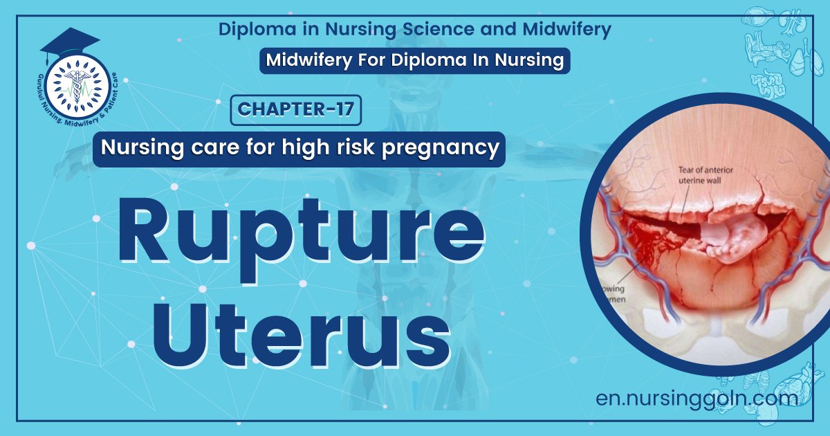 Rupture Uterus | Chapter 17 | Midwifery For Diploma In Nursing