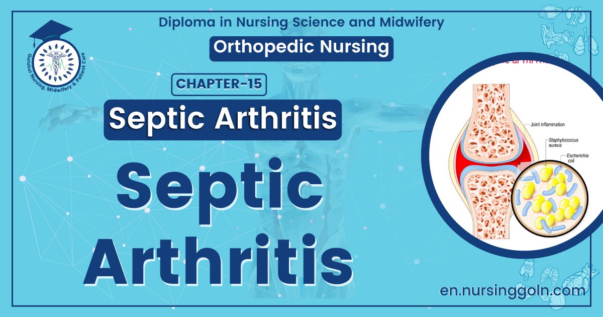 Septic arthritis | CHAPTER 15 | Orthopedic Nursing