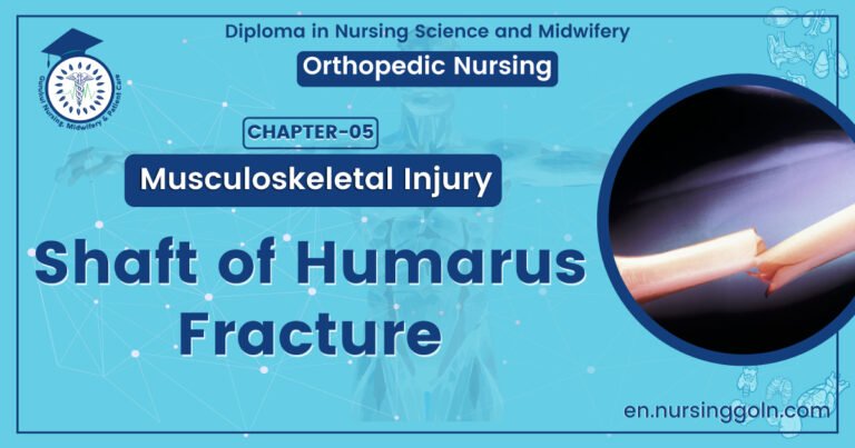 Shaft of Humarus fracture | CHAPTER 5 | Orthopedic Nursing