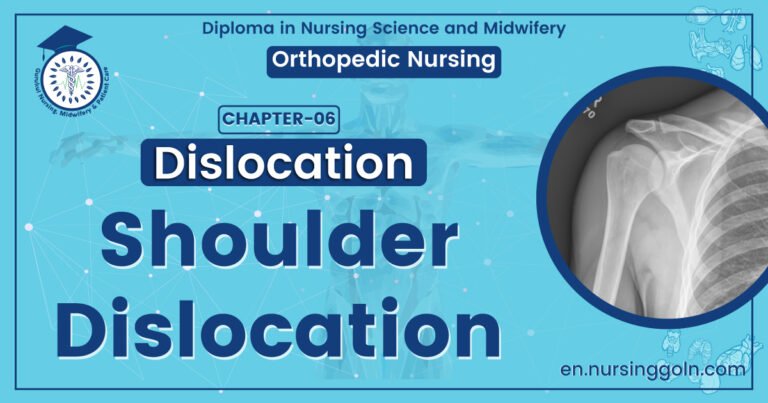 Shoulder dislocation | CHAPTER 6 | Orthopedic Nursing
