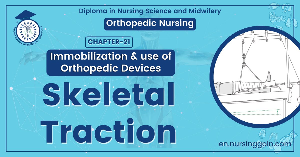 Skeletal Traction | CHAPTER 21 | Orthopedic Nursing