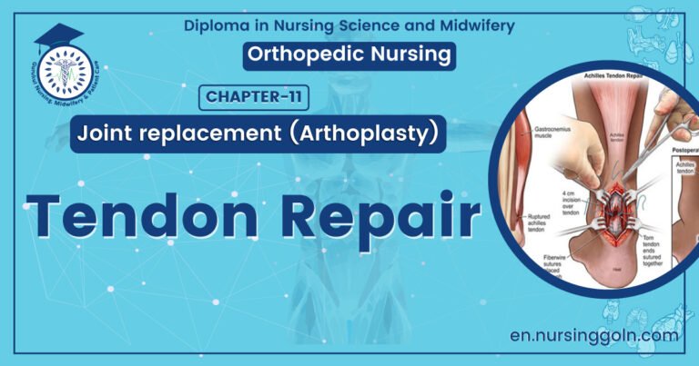 Tendon Repair | CHAPTER 11 | Orthopedic Nursing